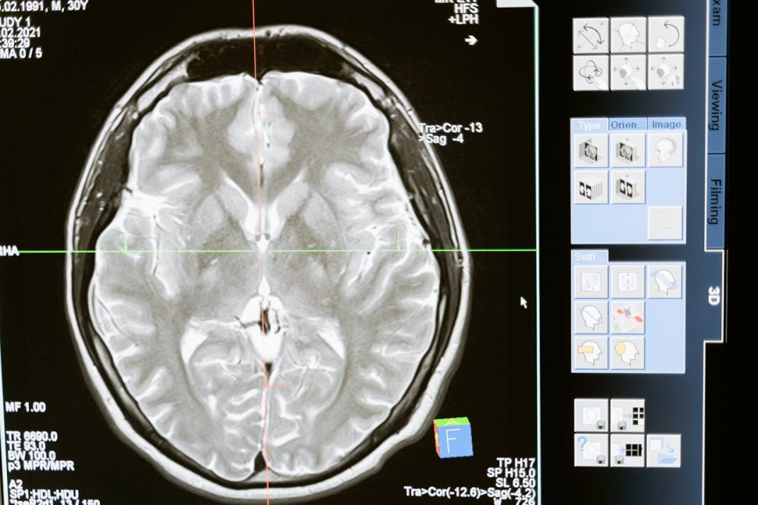 Guide pour choisir sa formation en neurosciences